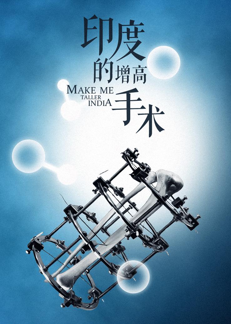 亚洲无间道：印度的增高手术