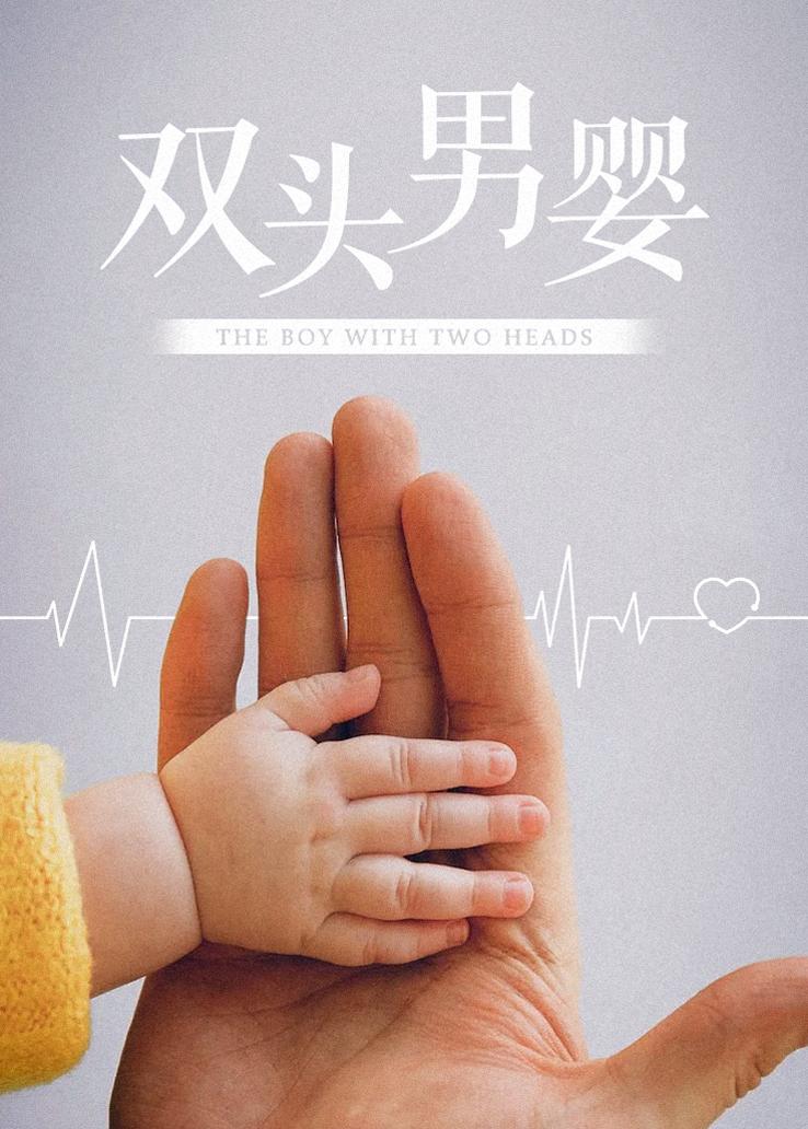 双头男婴
